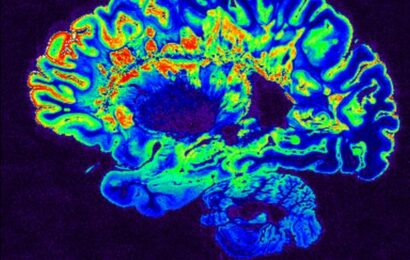 Herpes proti rakovině. Vědci využili virus oparu na léčbu nádoru mozku