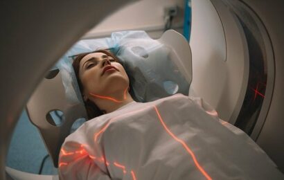 Segmentace MRI mozku – U-Net model