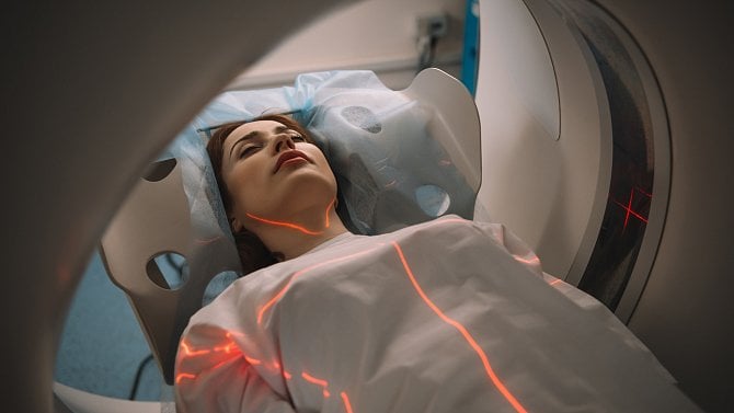 Segmentace MRI mozku – U-Net model Segmentace MRI mozku – U-Net model
