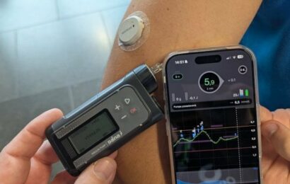 Umělá open‑source slinivka a SDR vysílačka na Linuxu, OpenAlt 2025